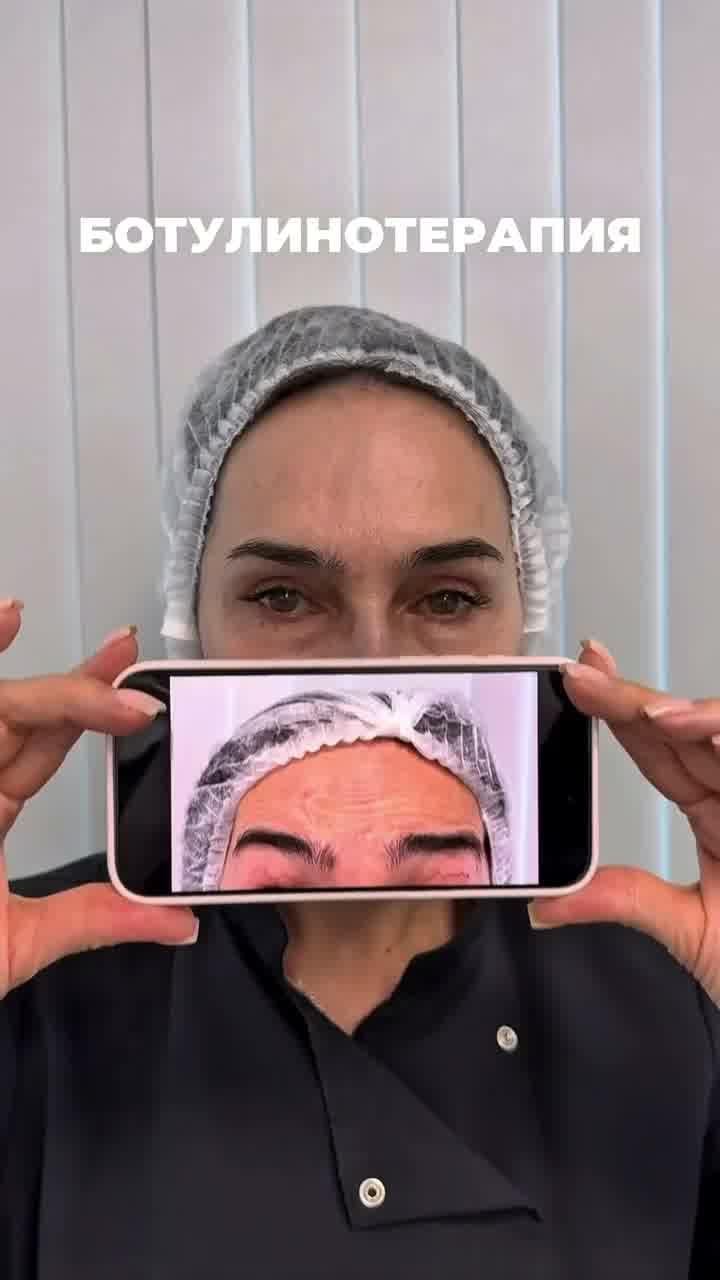 Результаты ботулинотерапии