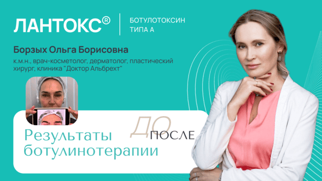 Результаты ботулинотерапии