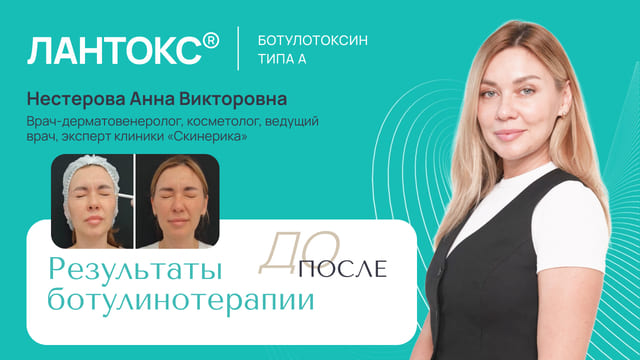 Результаты ботулинотерапии