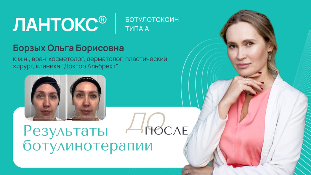 Мастер-класс: Применение ботулинического нейропротеина ЛАНТОКС® в постоперационном периоде после блефаропластики